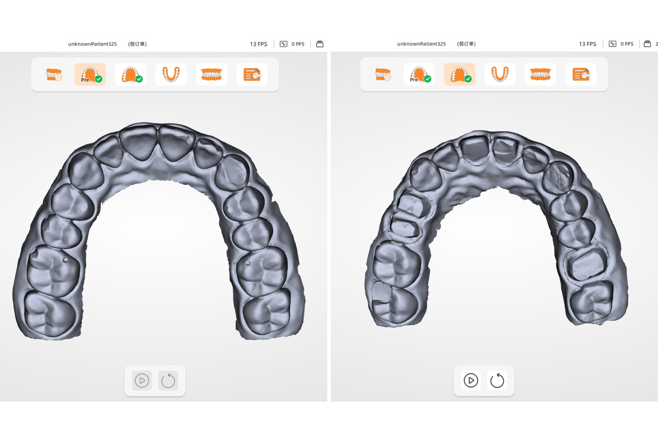 Pre-operative Oral Scan